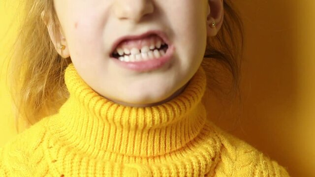 Smile with the teeth of a girl close-up. Malocclusion, exercises for correcting the bite in children, orthodontics. Children's facial expressions and emotions. Yellow background and sweater