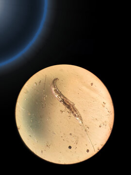 Zoological Specimen Of A Roundworm Under A Microscope