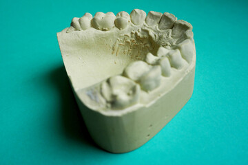 gypsum upper jaw lies on a turquoise background top view. dentistry. dental treatment © NataSel