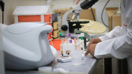 close up of a blood test microscope