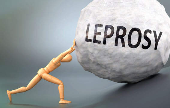 Leprosy and painful human condition, pictured as a wooden human figure pushing heavy weight to show how hard it can be to deal with Leprosy in human life, 3d illustration