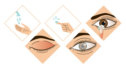 Contact lens infographic. Instruction how to put on lenses. 5 steps wash your hands, take a lens, check the position of the lens. Carefully insert the lens. Design of the brochure