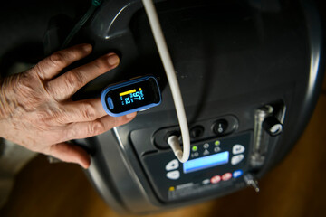View of a hand of a woman with an pulse oximeter clipped on the index finger. Hand lies on a...