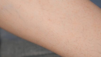 Unshaved leg of woman with long black hairs, closeup view. Bodycare at home. Body positive, feminism and natural view concept.