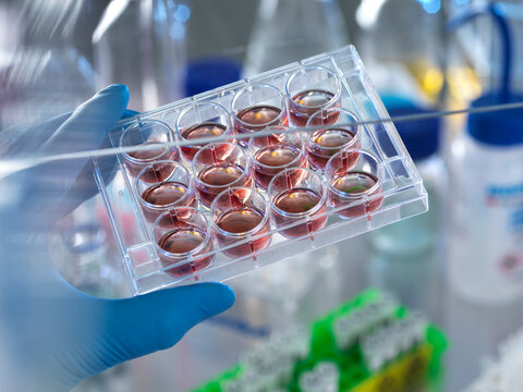 Scientist holding multi well plate with blood samples in laboratory