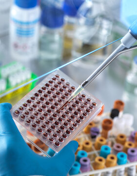 Male scientist pipetting blood sample in microplate at laboratory
