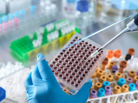 Scientist pipetting blood sample in microplate at laboratory
