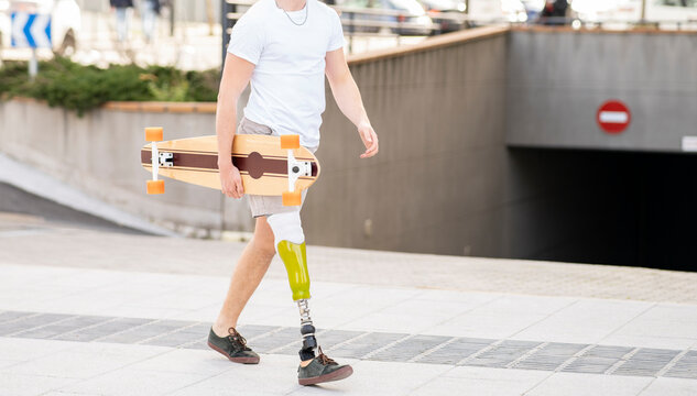 Young disabled man holding skateboard while walking on footpath