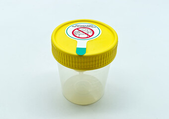 Plastic container for urine with yellow cap isolated on white background. Medical urine test