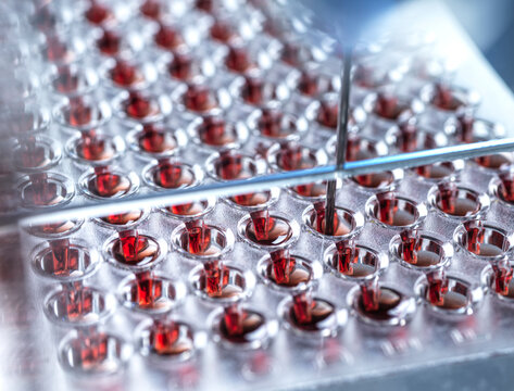 Blood samples in container at lab