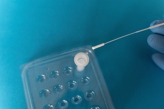 Studio shot of COVID-19 rapid diagnostic test in process