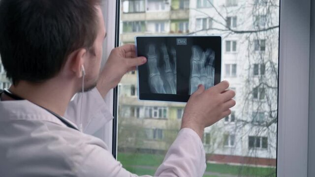 Young doctor looking at a x-ray picture, against the background of a window, against the background of a building, the concept of therapy and a doctor