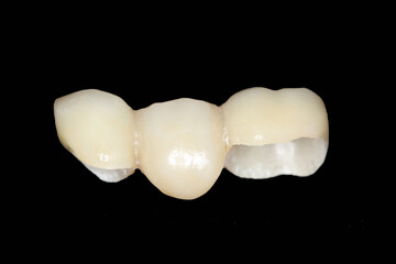 Zirconia bridge with all porcelain. smile make-over