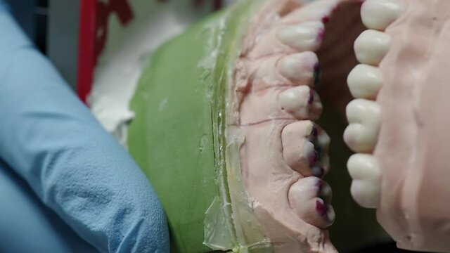 Plaster model in the hands of an orthodontist close up. Modem orthodontics. Slow motion