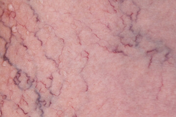 Close up of veins on human skin as background.