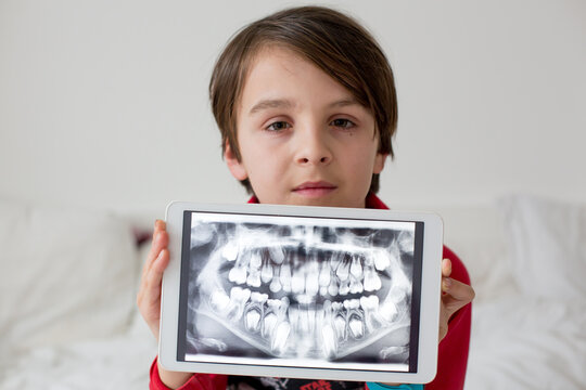 Child, preteen boy, holding tablet with a picture of his x-ray teeth