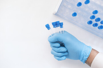 hand in blue medical gloves holding blood test tube 