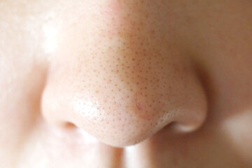 鼻の毛穴（正面）