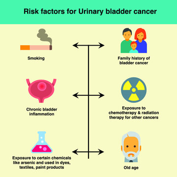 Risk Factor For Urinary Bladder Cancer Are Smoking, Family History Of Cancer, Chronic Bladder Inflammation, Exposure To Chemo And Radiation Therapy For Other Cancers, Exposure To Chemicals, Old Age