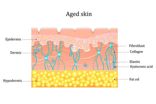 Aged skin layer. Human skin structure with collagen and elastane fibers, hyaluronic acids, fibroblasts. Schematic illustration. Vector diagram