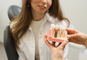 First person shot female doctor talking to a young woman patient. Discussion of the treatment plan. The dentist shows a model of a dental implant. Modern dental clinic