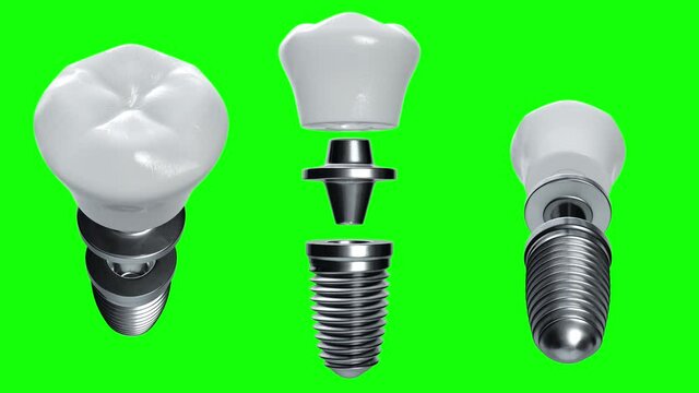3d rendering motion looping set of titanium dental implant on the green screen background.