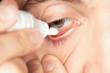 apply eyedrops drugs to male eyeball to prevent allergy and diseases