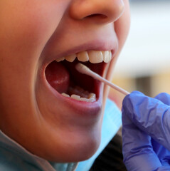 young girl with open mouth while taking a swab to detect coronavirus with blue glove