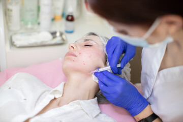 Obraz na płótnie Canvas Beautiful woman during facial mesotherapy or biorevitalization. Doctor beautician makes anti-aging injections for skin anti wrinkle therapy and nutrition