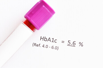 Blood sample tube with normal HbA1c test result