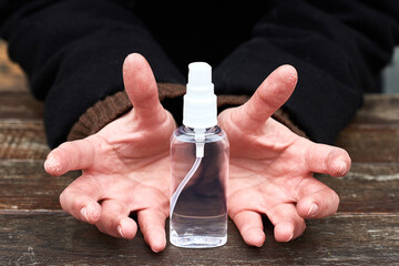 dry skin on hands. concept of manifestation of vitamin deficiency. shallow depth of field photo