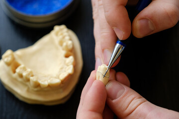 The dental technician is engaged in a modeling of artificial dentures. The hands of a dental technician close-up
