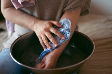 Woman treating burns on her hand, applying cold water on injured skin