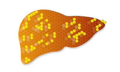 Liver treatment with hexagons, vector art illustration.