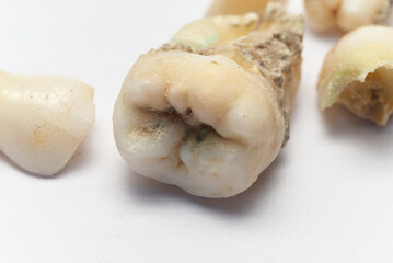 rotten tooth 