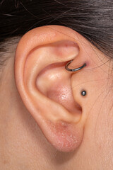 Close-up detail of piercing infection. Woman ear tragus and forward helix piercing.