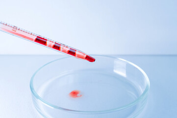 Medical laboratory. The blood from the pipette is poured into an empty Petri dish on a blue...