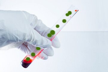 Medical laboratory. Virus-infected blood in a test tube held by a hand in a medical glove....