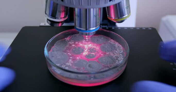 A medical scientist places a Petri dish with bacteria under a microscope magnification, with red light, for detailed analysis.
