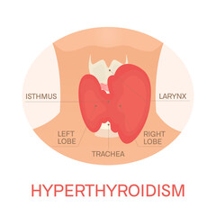 Thyroid gland and trachea shown on a silhouette of a woman. Body anatomy sign. Human endocrine system. Medical internal organ vector illustration.