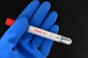 Nasopharyngeal swab positive with COVID-19 test 
