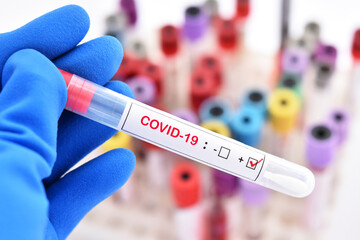 Obraz premium Nasopharyngeal swab positive with COVID-19 test 