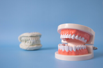 Close up plastic human teeth model and the plaster tooth model placed on the blue background. Dental examination and dental treatment concept. Regular oral health is vital to oral health.