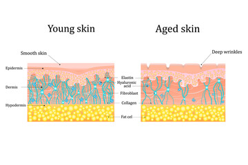 Vector illustration of age-related changes in the skin. Comparison of young and old skin. Structure human skin with collagen and elastin fibers, fibroblasts.