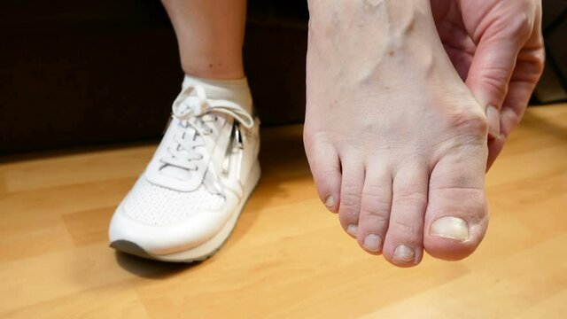 woman's hand massaging her bunion toes in bare feet to relieve pain. woman leg in white sneakers. Woman feet problem. Hallux valgus.