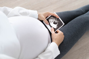 A pregnant woman is looking at an ultrasound photo of fetus. Mother gently touches the baby on stomach.Women are pregnant for 2-3 days or during the first trimester.