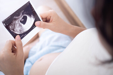 A pregnant woman is looking at an ultrasound photo of fetus. Mother gently touches the baby on stomach.Women are pregnant for 2-3 days or during the first trimester.