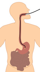 Upper endoscopy. Digestive system Illustration. GI tract. Mouth, esophagus, stomach and intestine