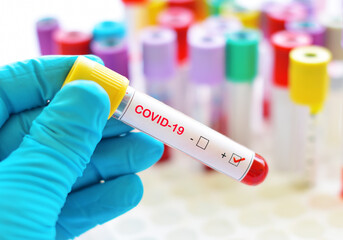 Fototapeta premium Blood sample tube positive with COVID-19 virus 