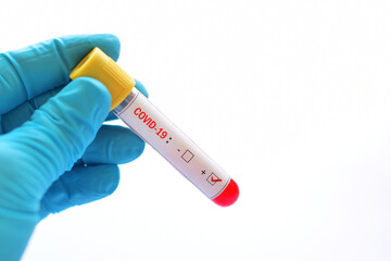 Fototapeta premium Blood sample tube positive with COVID-19 virus 